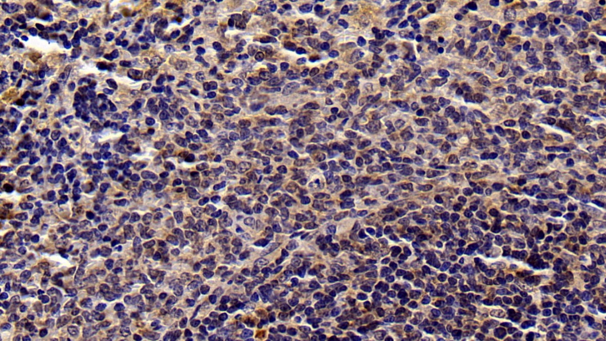 Monoclonal Antibody to Signal Transducer And Activator Of Transcription 3 (STAT3)