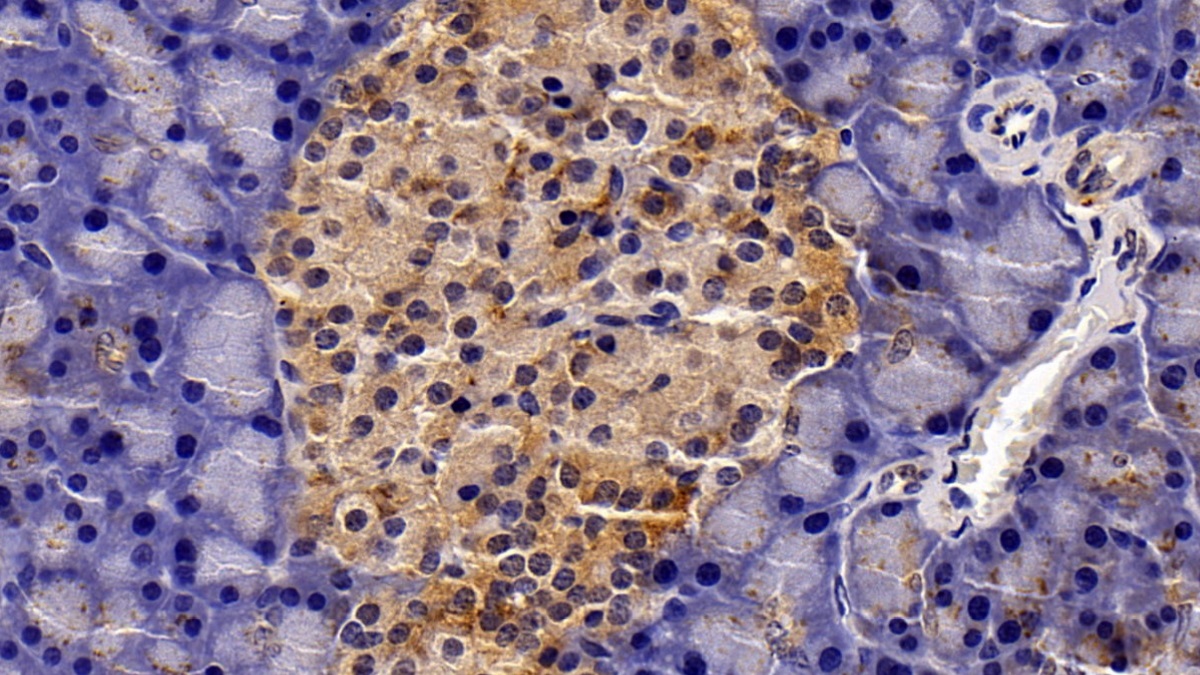 Monoclonal Antibody to Signal Transducer And Activator Of Transcription 3 (STAT3)