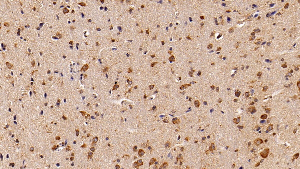 Monoclonal Antibody to Signal Transducer And Activator Of Transcription 3 (STAT3)