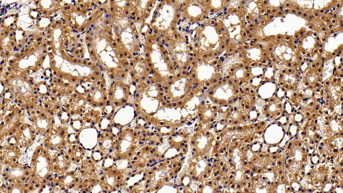 Monoclonal Antibody to Signal Transducer And Activator Of Transcription 3 (STAT3)