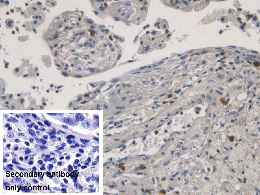 Monoclonal Antibody to Ribonuclease A3 (RNASE3)