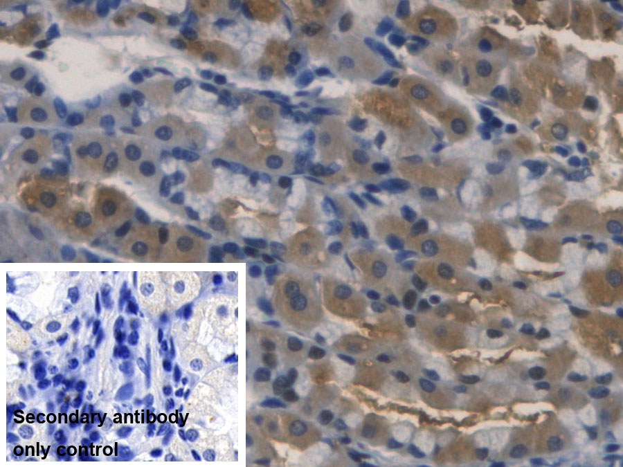 Monoclonal Antibody to Ribonuclease A3 (RNASE3)