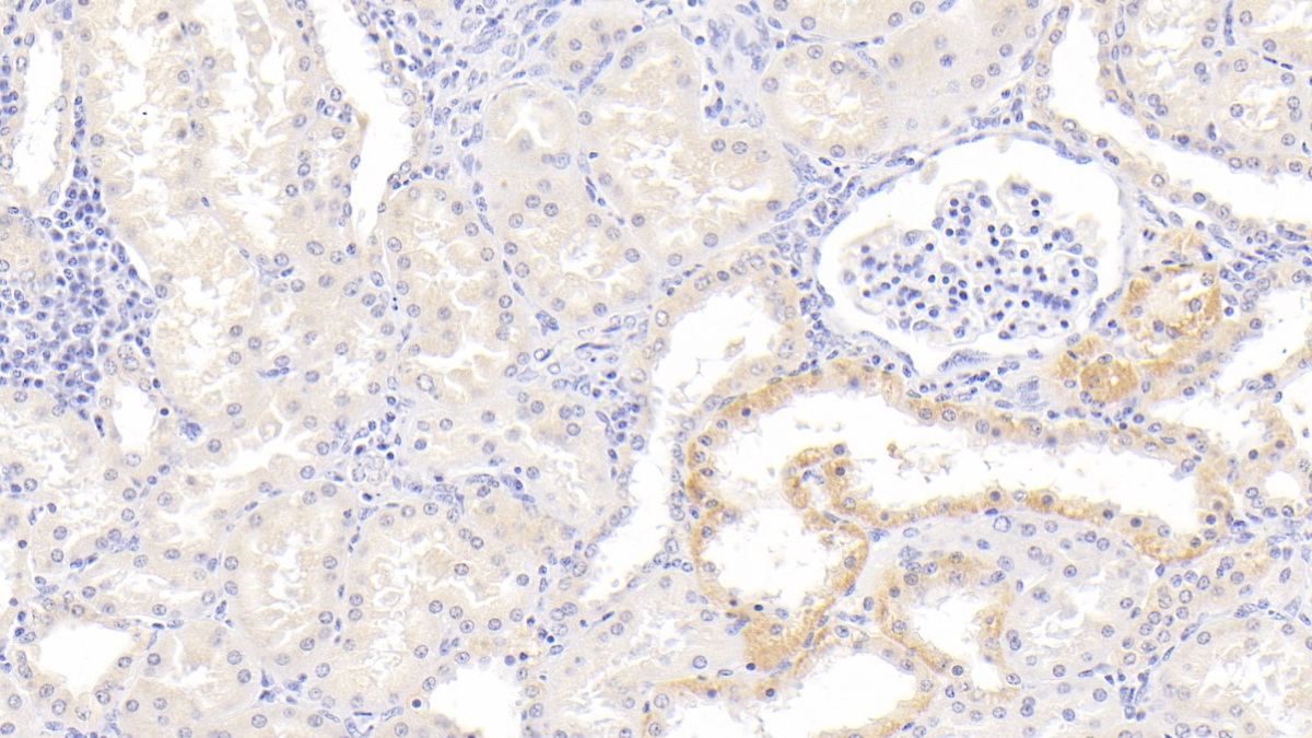 Monoclonal Antibody to Inhibin Beta B (INHbB)