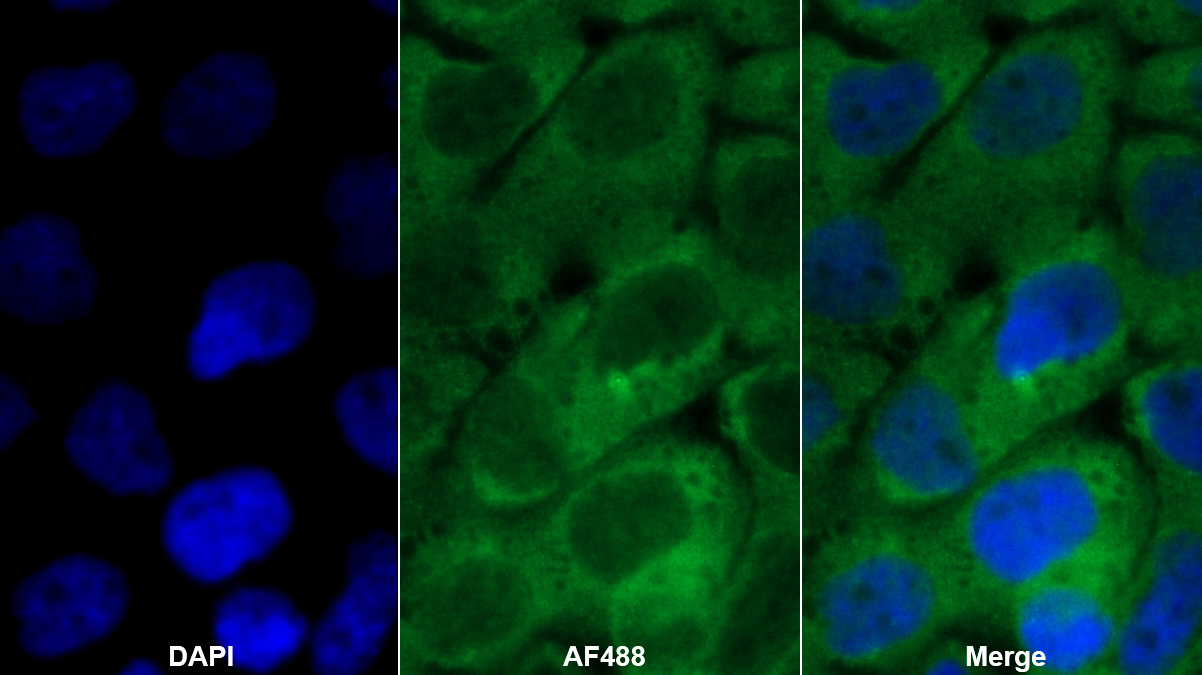 Monoclonal Antibody to Inhibin Beta B (INHbB)