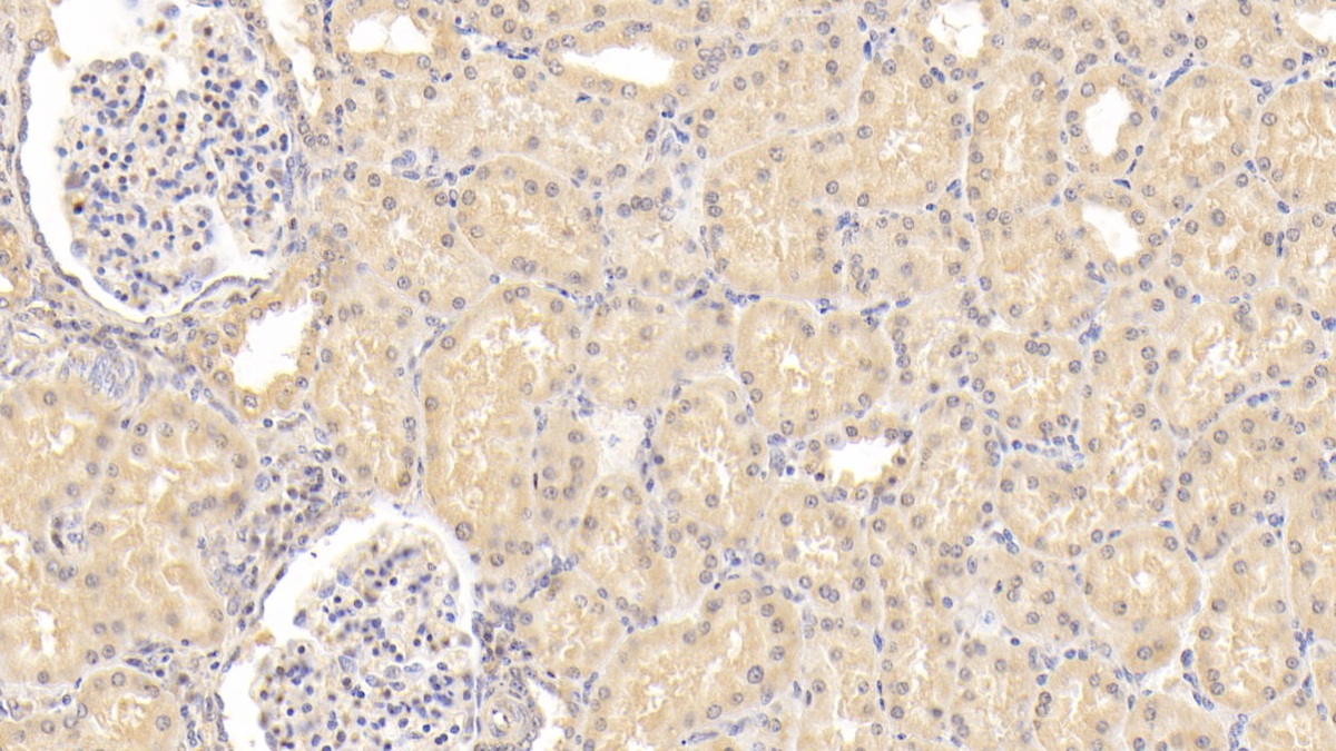 Monoclonal Antibody to Inhibin Beta B (INHbB)