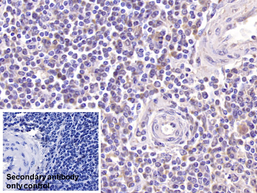 Monoclonal Antibody to Killer Cell Lectin Like Receptor Subfamily K, Member 1 (KLRK1)