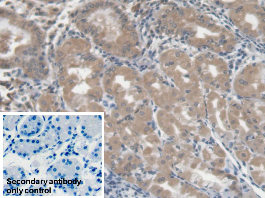 Monoclonal Antibody to Lectin Galactoside Binding, Soluble 3 Binding Protein (LGALS3BP)