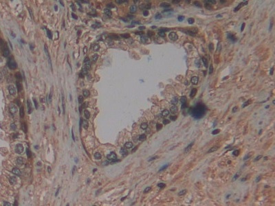 Monoclonal Antibody to S100 Calcium Binding Protein A6 (S100A6)