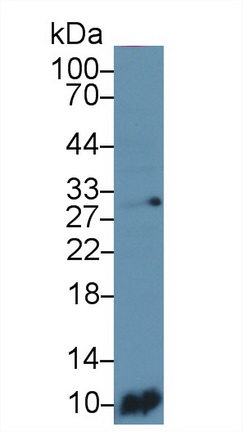 Monoclonal Antibody to S100 Calcium Binding Protein A6 (S100A6)