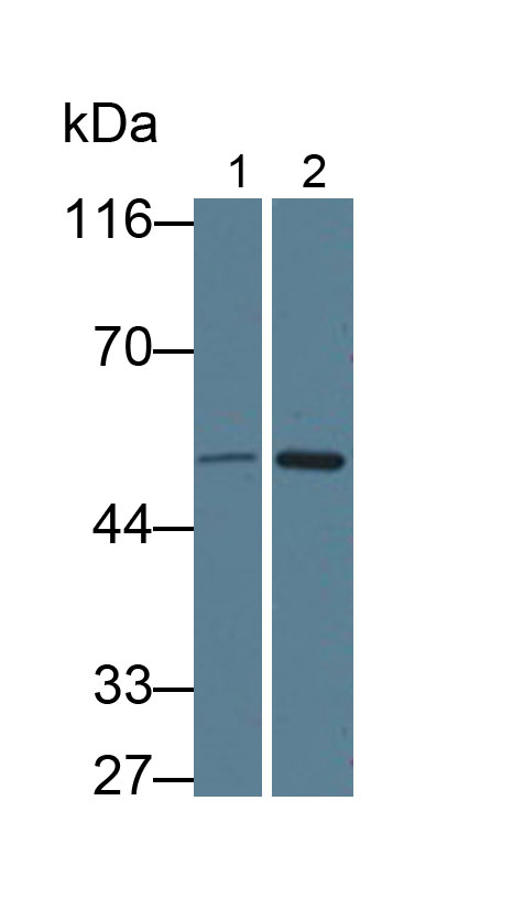 Monoclonal Antibody to Orosomucoid 2 (ORM2)