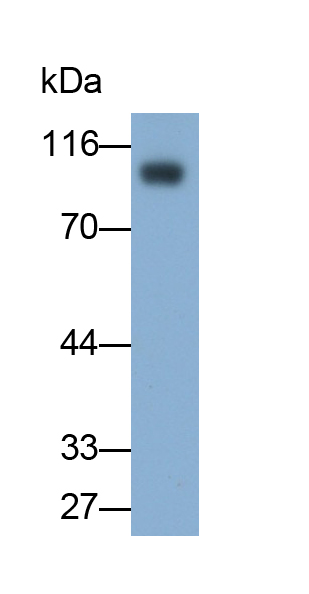 Monoclonal Antibody to Neprilysin (CD10)