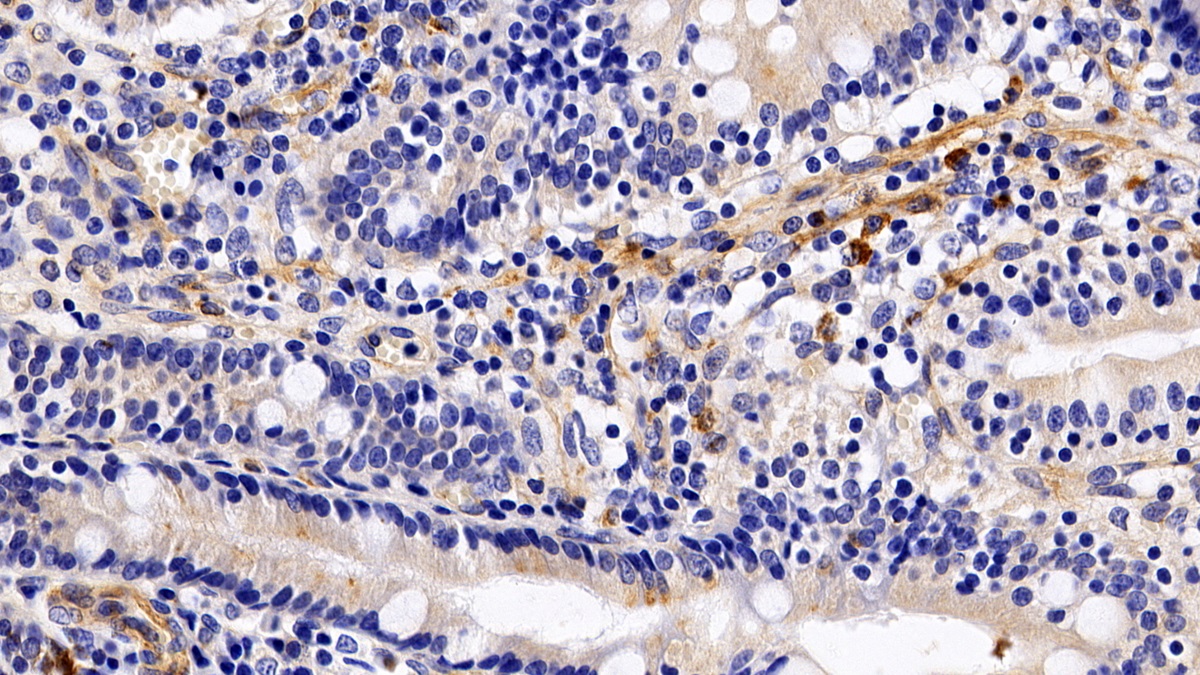 Monoclonal Antibody to Sialic Acid Binding Ig Like Lectin 7 (SIGLEC7)