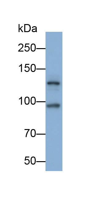 Monoclonal Antibody to Fibroblast Growth Factor Receptor 1 (FGFR1)