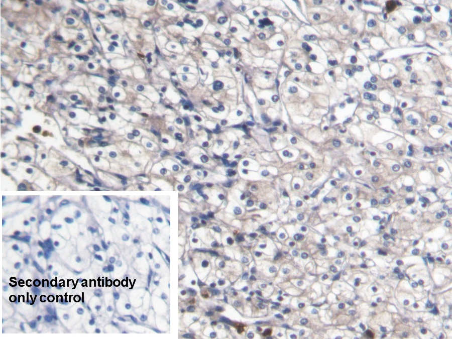 Monoclonal Antibody to S100 Calcium Binding Protein A8 (S100A8)