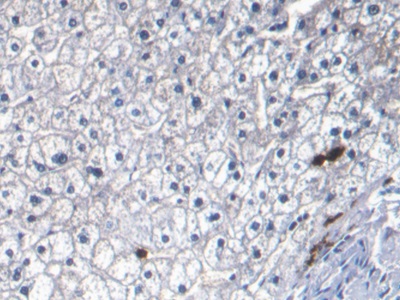 Monoclonal Antibody to S100 Calcium Binding Protein A8 (S100A8)