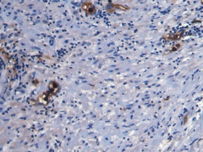 Monoclonal Antibody to S100 Calcium Binding Protein A8 (S100A8)