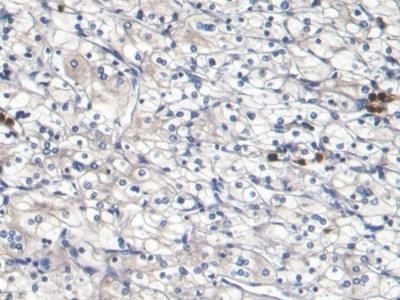 Monoclonal Antibody to S100 Calcium Binding Protein A8 (S100A8)