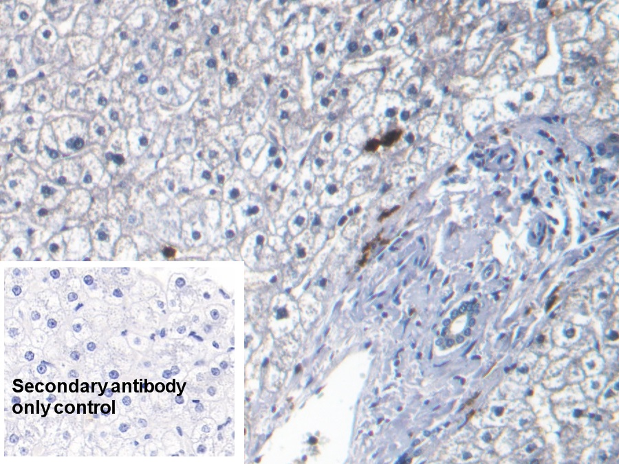 Monoclonal Antibody to S100 Calcium Binding Protein A8 (S100A8)