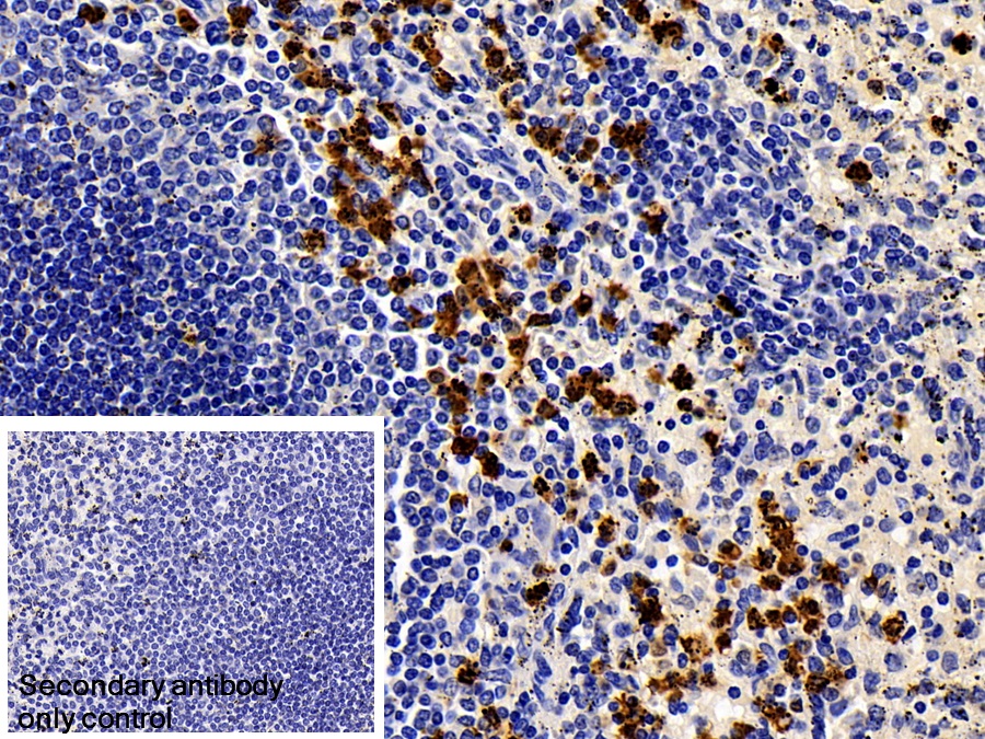 Monoclonal Antibody to S100 Calcium Binding Protein A8 (S100A8)