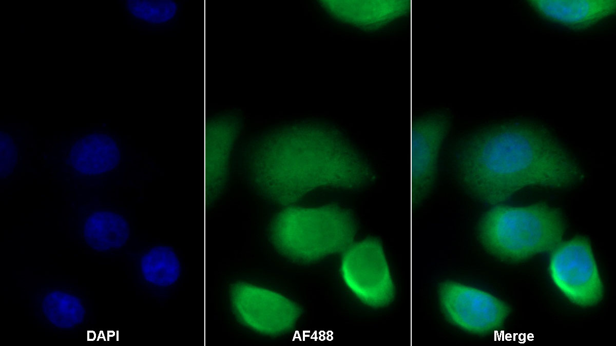 Monoclonal Antibody to S100 Calcium Binding Protein A8 (S100A8)