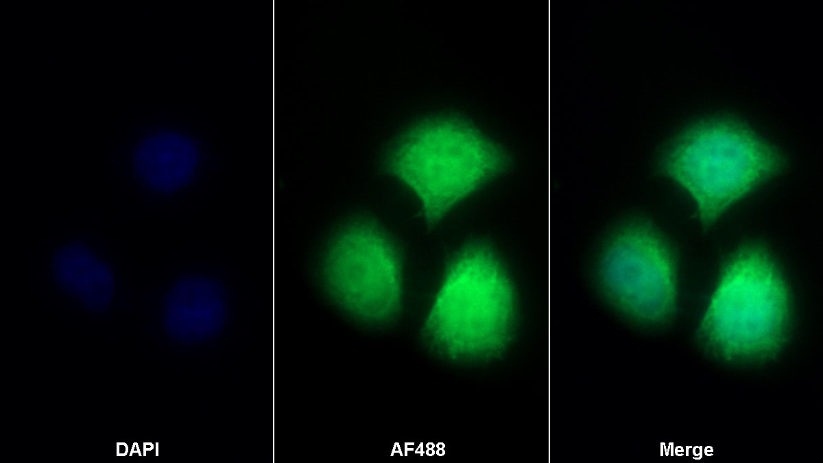 Monoclonal Antibody to S100 Calcium Binding Protein A8 (S100A8)