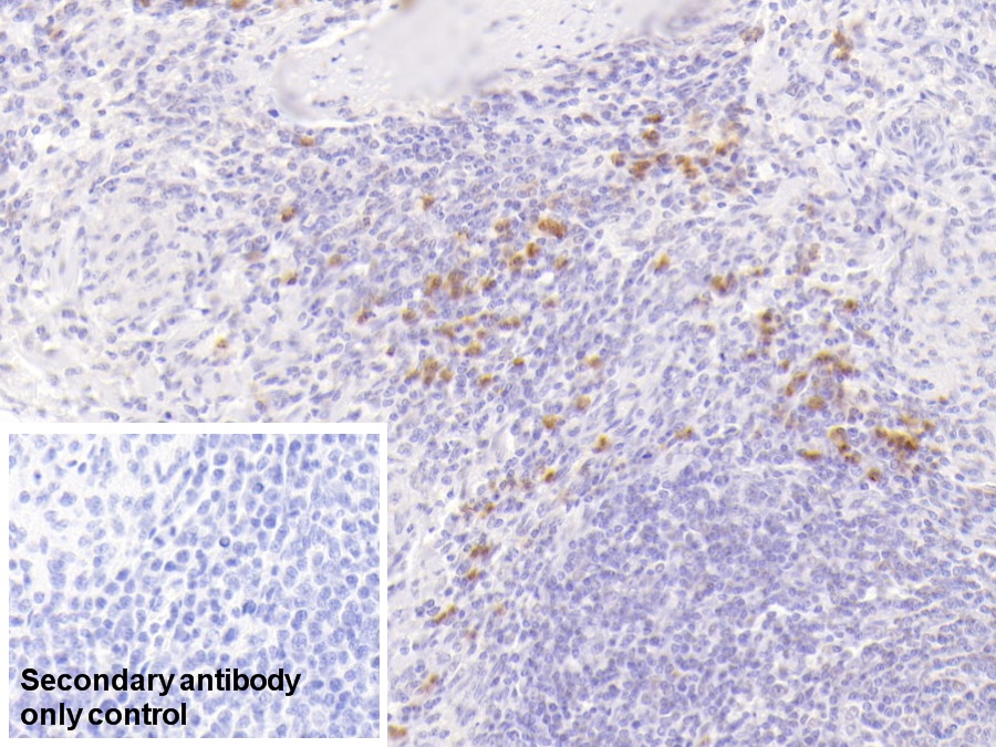 Monoclonal Antibody to S100 Calcium Binding Protein A9 (S100A9)