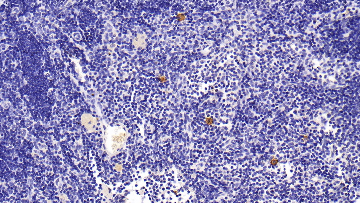 Monoclonal Antibody to S100 Calcium Binding Protein A9 (S100A9)