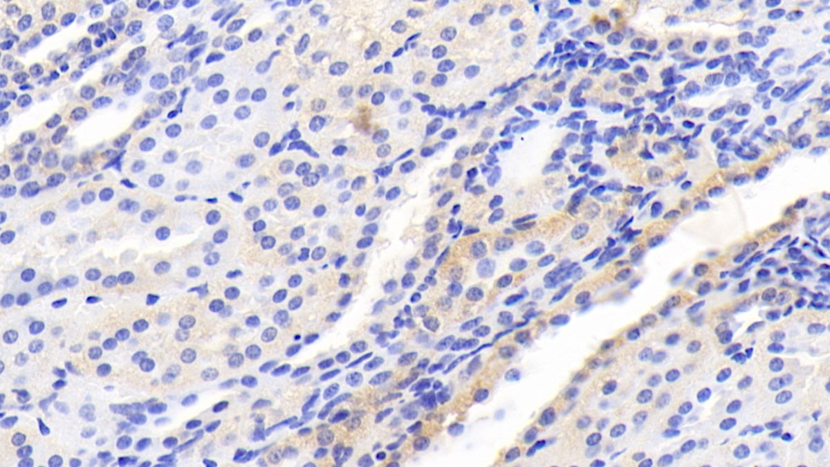 Monoclonal Antibody to Serine/threonine-protein kinase mTOR (mTOR)