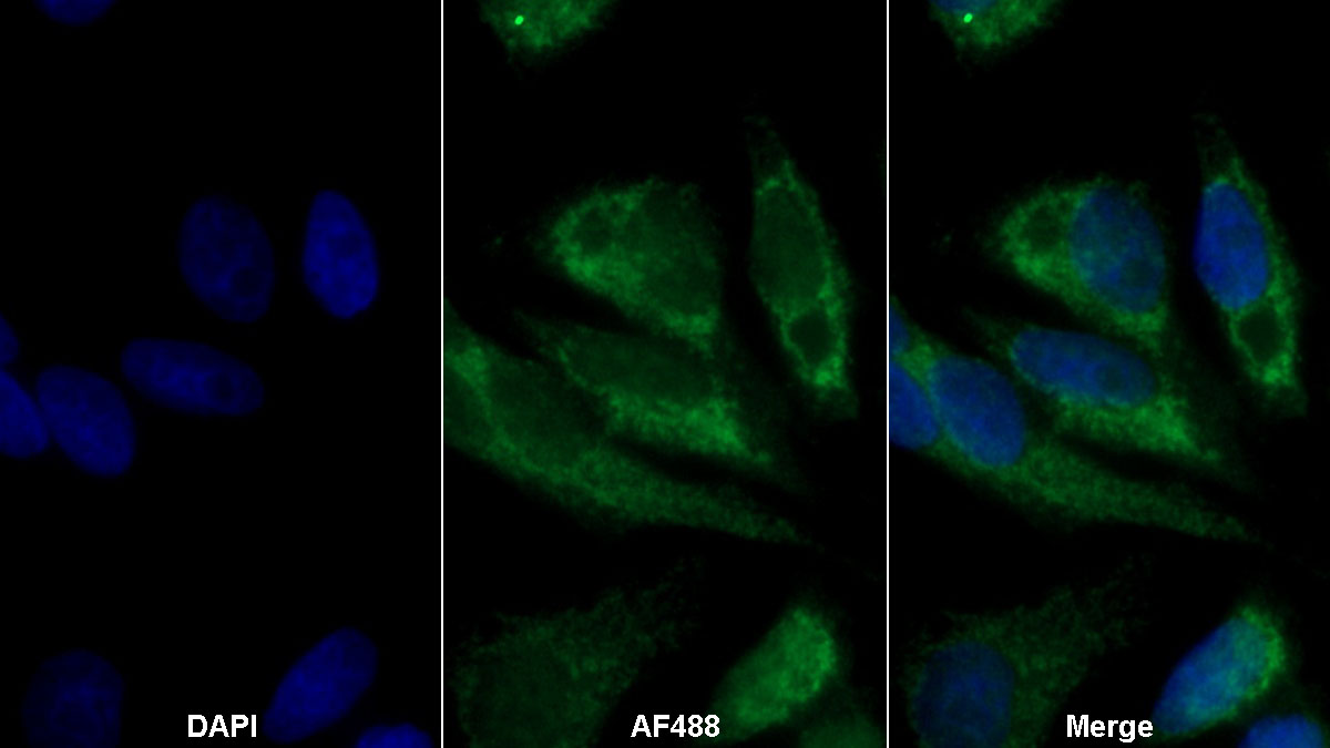 Monoclonal Antibody to Selenoprotein P1, Plasma (SEPP1)