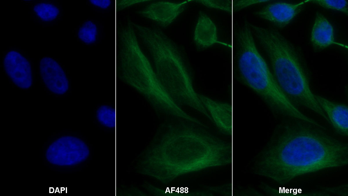 Monoclonal Antibody to Selenoprotein P1, Plasma (SEPP1)