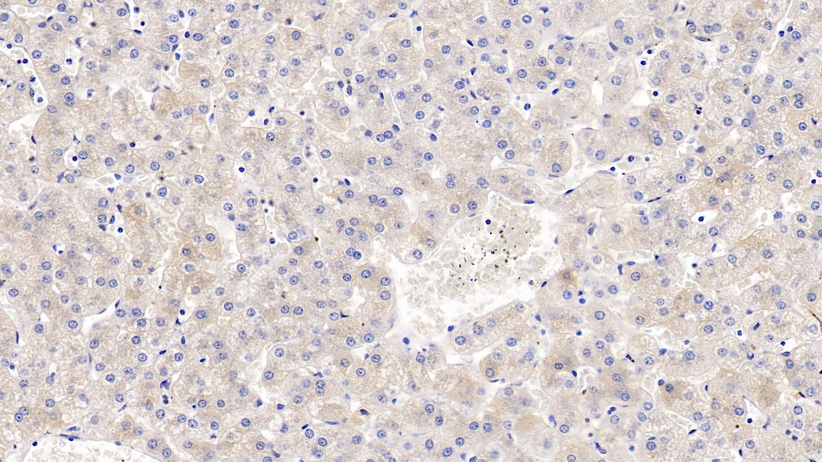 Monoclonal Antibody to Vitamin D Binding Protein (DBP)