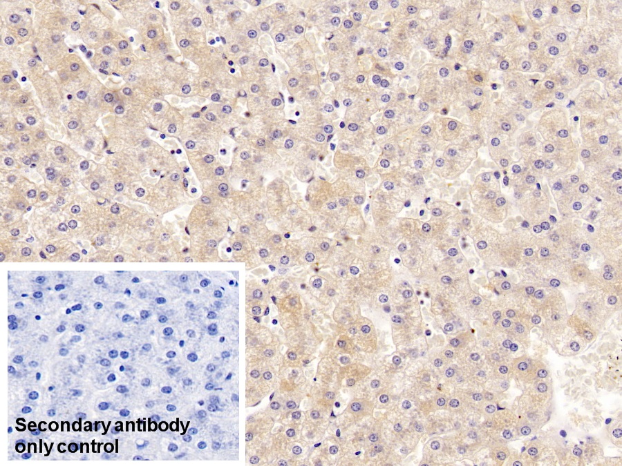 Monoclonal Antibody to Vitamin D Binding Protein (DBP)