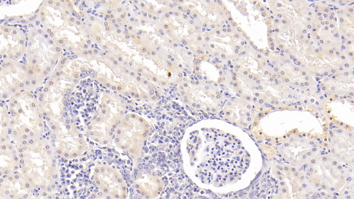 Monoclonal Antibody to Vitamin D Binding Protein (DBP)