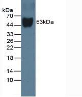 Monoclonal Antibody to Vitamin D Binding Protein (DBP)