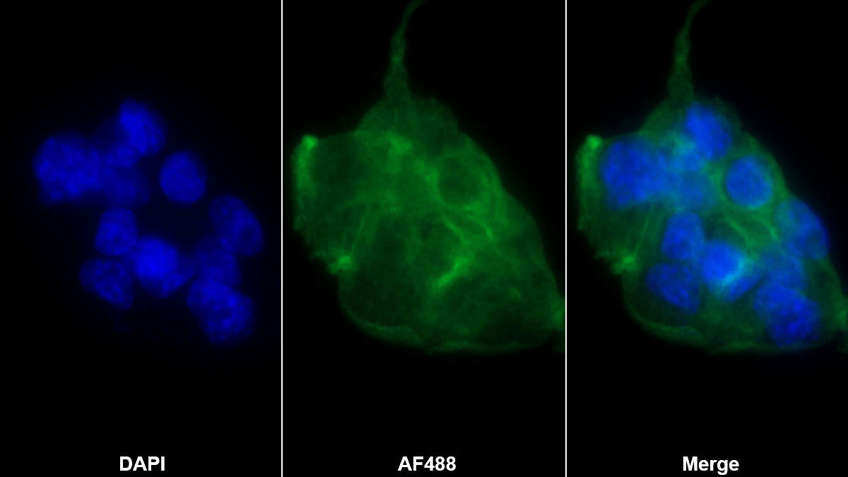 Monoclonal Antibody to Vitamin D Binding Protein (DBP)