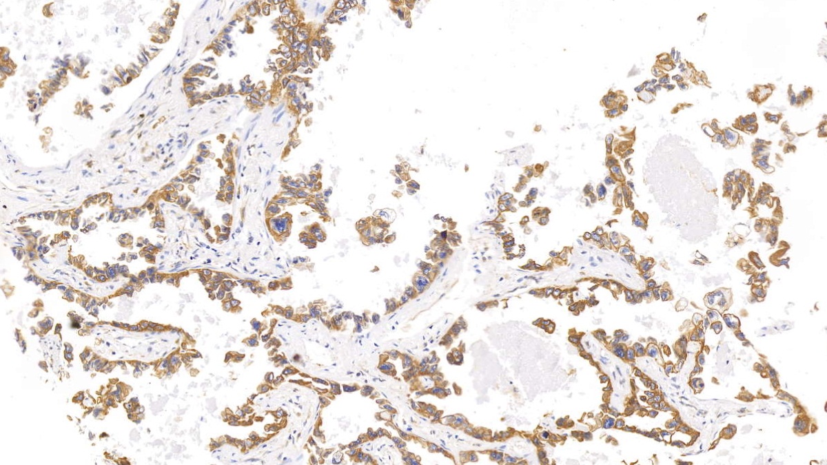 Monoclonal Antibody to Cytokeratin 17 (CK17)