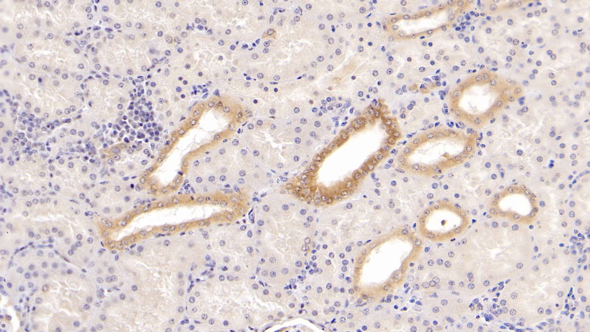 Monoclonal Antibody to Cytokeratin 17 (CK17)