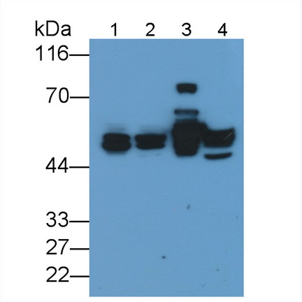 Monoclonal Antibody to Cytokeratin 17 (CK17)