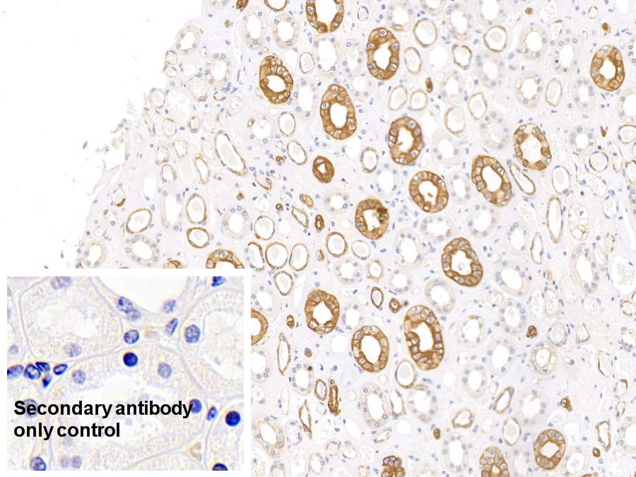 Monoclonal Antibody to Cytokeratin 17 (CK17)