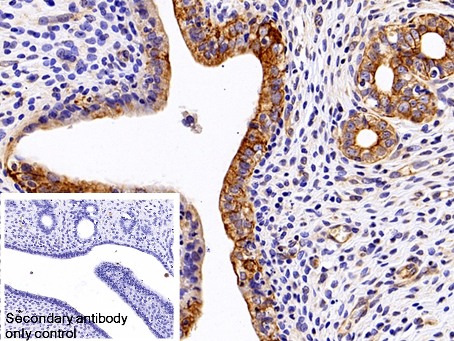 Monoclonal Antibody to Cytokeratin 17 (CK17)