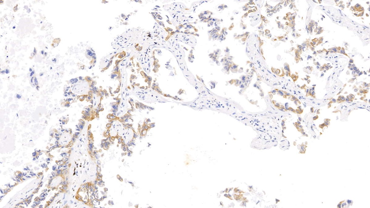 Monoclonal Antibody to Cytokeratin 17 (CK17)