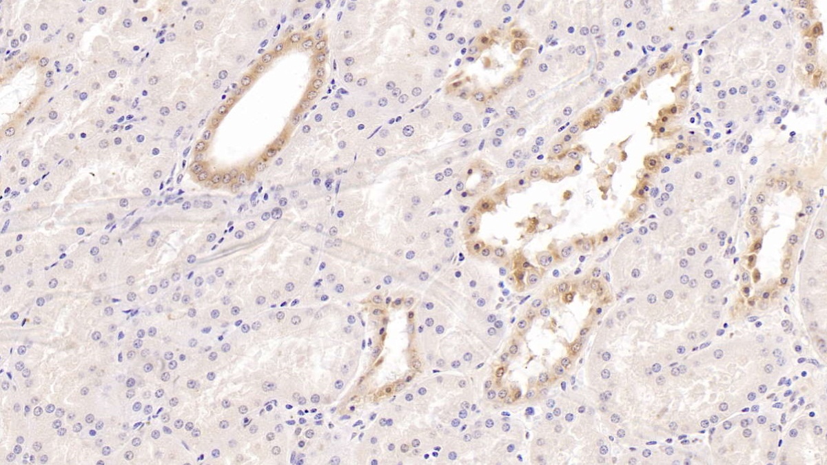 Monoclonal Antibody to Cytokeratin 17 (CK17)