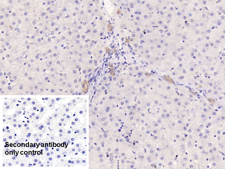 Monoclonal Antibody to Cytokeratin 17 (CK17)