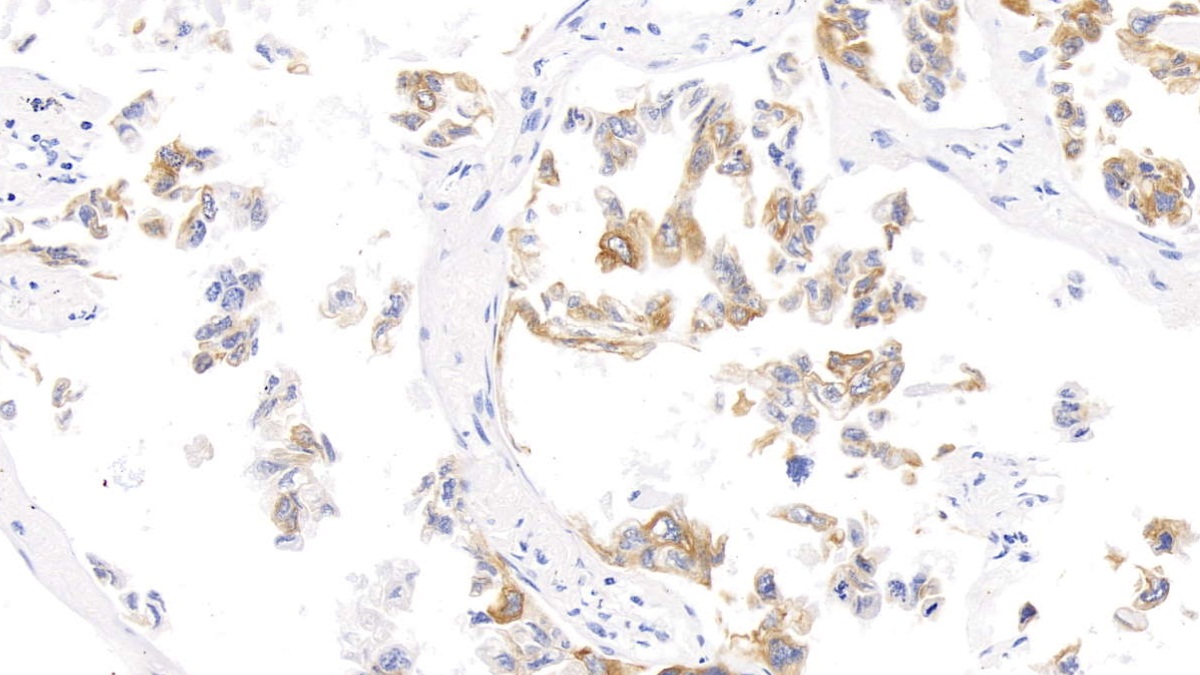 Monoclonal Antibody to Cytokeratin 17 (CK17)