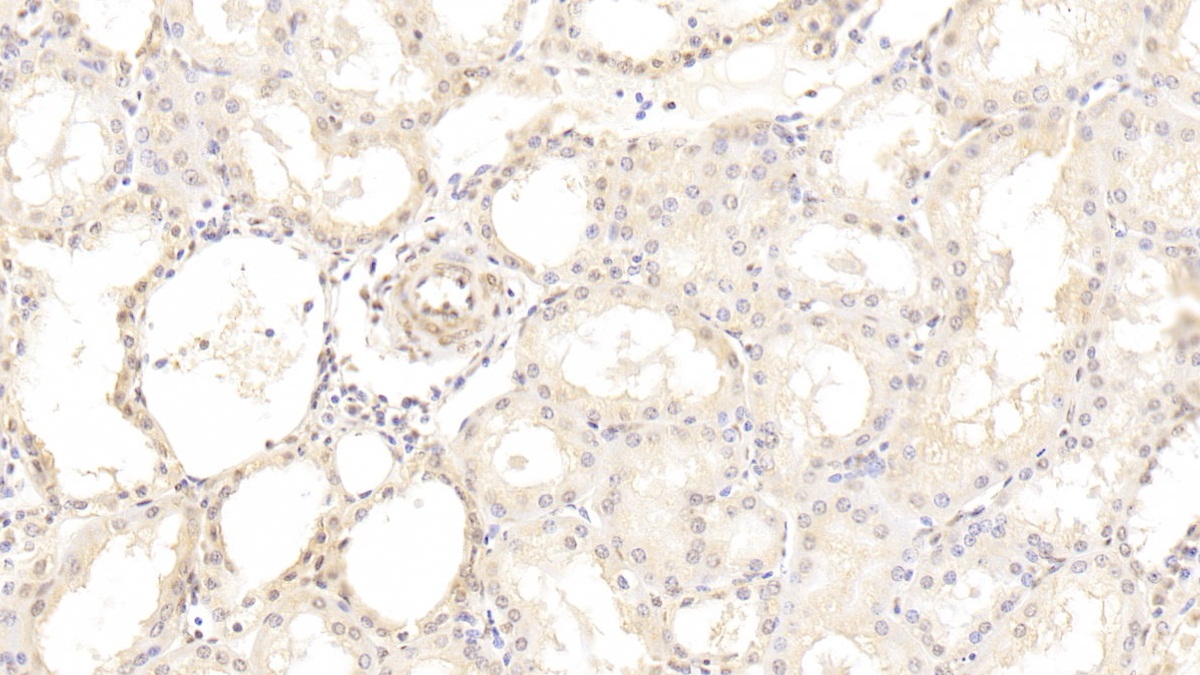 Monoclonal Antibody to Hedgehog Homolog, Sonic (SHH)