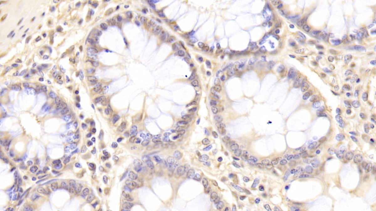 Monoclonal Antibody to Hedgehog Homolog, Sonic (SHH)