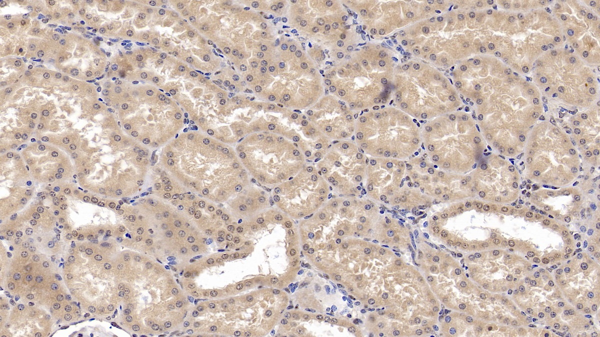 Monoclonal Antibody to Hedgehog Homolog, Sonic (SHH)