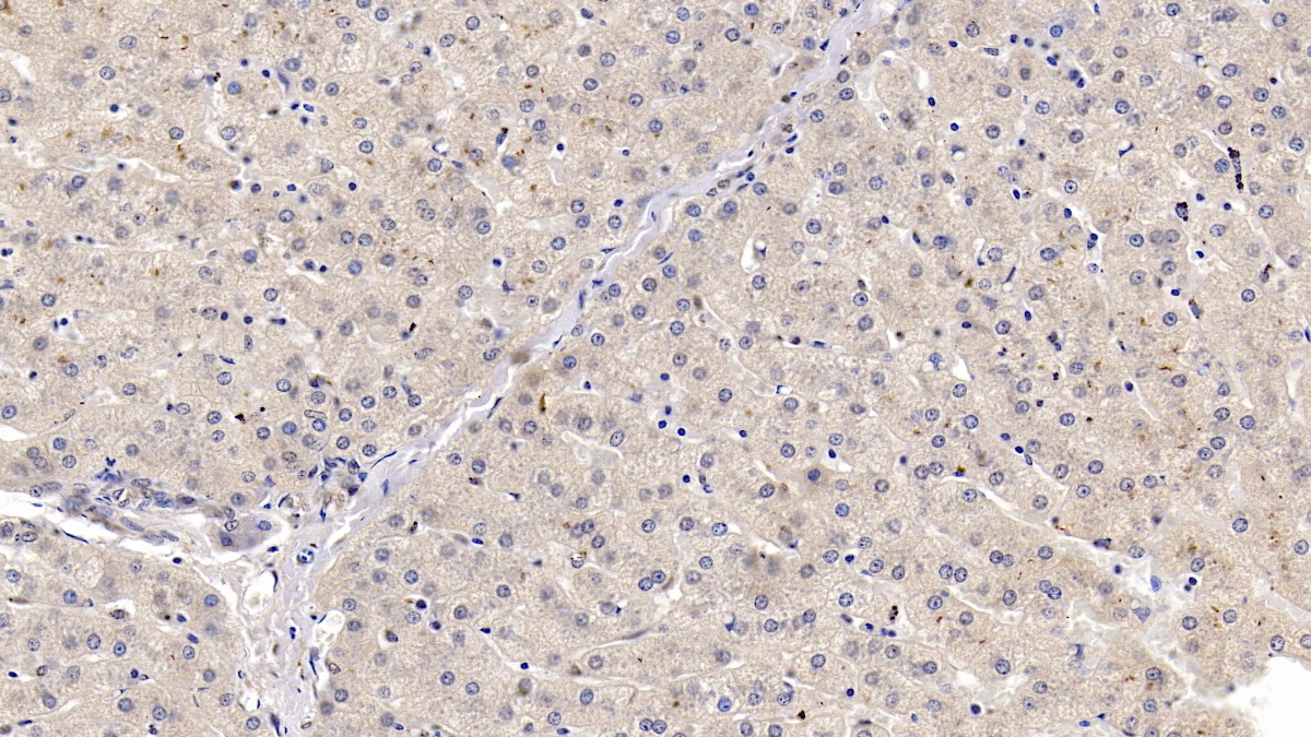 Monoclonal Antibody to Hedgehog Homolog, Sonic (SHH)