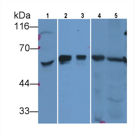 Monoclonal Antibody to Hedgehog Homolog, Sonic (SHH)