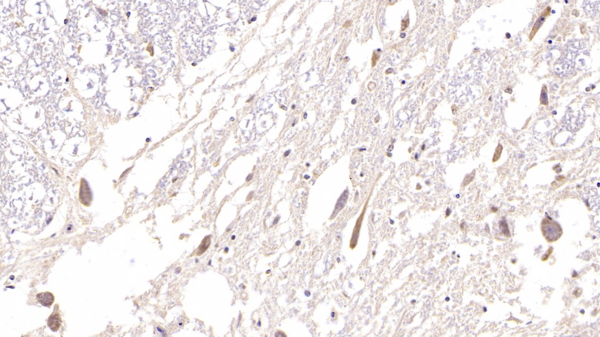 Monoclonal Antibody to Hedgehog Homolog, Sonic (SHH)